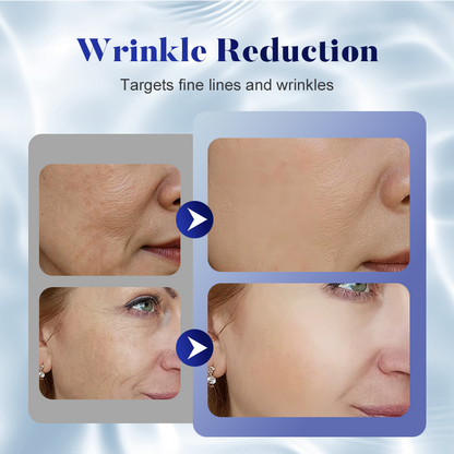 ✨ BUY 2 GET 1 FREE! 🎉 Anti-Wrinkle Firming Face Cream – Deep Hydration, Lifts & Smooths Skin, Vitamin Enriched Formula 🌟📦